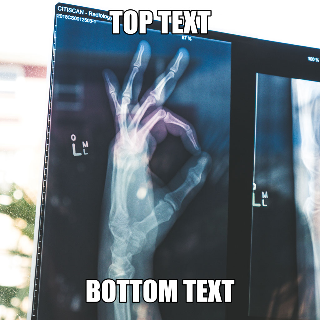 X-ray image of a hand making an 'okay' gesture with top and bottom text overlays